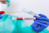 Coronavirus in Irpinia, i dati di oggi 24 Dicembre