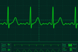 Mercogliano – Dalla Clinica Montevergine la rivoluzione dell’elettriocardiogramma
