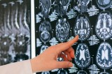 Associazione Carla Russo: “Nasce documento per dare impulso a neuro-oncologia campana” Associazione Carla Russo: “Nasce documento per dare impulso a neuro-oncologia campana”