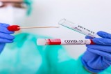 Covid in Irpinia, i dati di oggi Covid in Irpinia, i dati di oggi