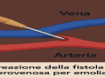 Dialisi: nuova tecnica mini-invasiva ad Avellino Dialisi: nuova tecnica mini-invasiva ad Avellino