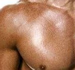 Muscoli