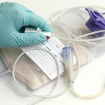 Gastrostomia_endoscopica_percutanea