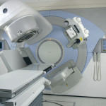 radioterapia